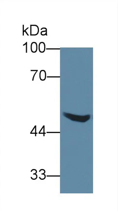 Western blot - Anti-AGXT2 antibody (AB231815)