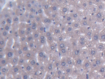 Immunohistochemistry (Formalin/PFA-fixed paraffin-embedded sections) - Anti-AGXT2 antibody (AB232803), expandable thumbnail