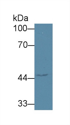 Western blot - Anti-AGXT2 antibody (AB232803), expandable thumbnail