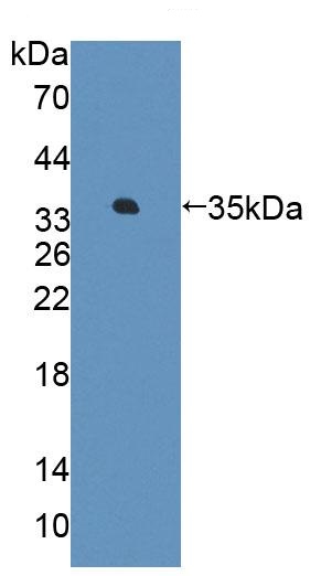 Western blot - Anti-AGXT2 antibody (AB232803), expandable thumbnail