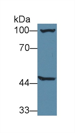 Western blot - Anti-AGXT2 antibody (AB232803), expandable thumbnail