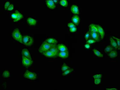 Immunocytochemistry/ Immunofluorescence - Anti-AGXT2 antibody (AB237622)