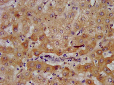 Immunohistochemistry (Formalin/PFA-fixed paraffin-embedded sections) - Anti-AGXT2 antibody (AB237622)
