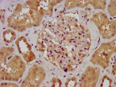 Immunohistochemistry (Formalin/PFA-fixed paraffin-embedded sections) - Anti-AGXT2 antibody (AB237622)