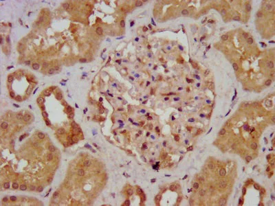 Immunohistochemistry (Formalin/PFA-fixed paraffin-embedded sections) - Anti-AGXT2 antibody (AB237622)