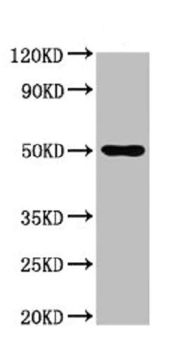 Western blot - Anti-AGXT2 antibody (AB237622)