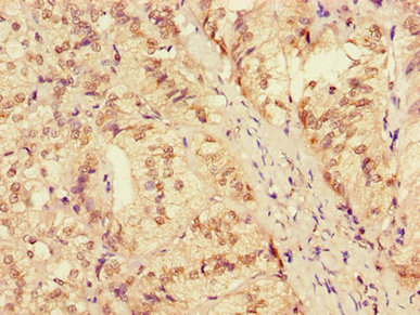 Immunohistochemistry (Formalin/PFA-fixed paraffin-embedded sections) - Anti-AH2 antibody (AB223032)