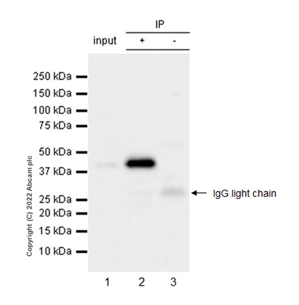 Immunoprecipitation - Anti-AHA1 antibody [EPR26852-47] (AB307716), expandable thumbnail