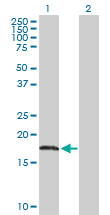 Western blot - Anti-AHNAK antibody (AB168104)