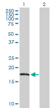 Western blot - Anti-AHNAK antibody (AB168104)