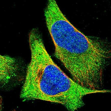Immunocytochemistry/ Immunofluorescence - Anti-AHNAK antibody (AB223762)