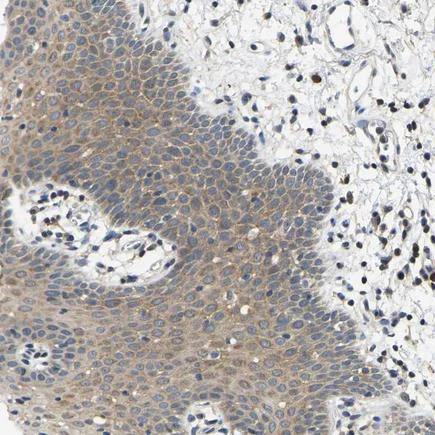 Immunohistochemistry (Formalin/PFA-fixed paraffin-embedded sections) - Anti-AHNAK antibody (AB223762)