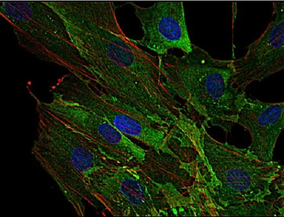 Immunocytochemistry - Anti-AHNAK antibody [EM-09] (AB68556)