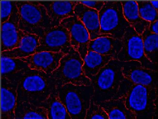 Immunocytochemistry - Anti-AHNAK antibody [EM-09] (AB68556)