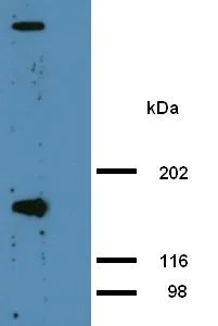 Western blot - Anti-AHNAK antibody [EM-09] (AB68556)