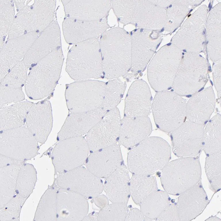 Immunohistochemistry (Formalin/PFA-fixed paraffin-embedded sections) - Anti-AHNAK2 antibody (AB224055)