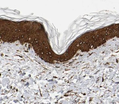 Immunohistochemistry (Formalin/PFA-fixed paraffin-embedded sections) - Anti-AHNAK2 antibody (AB224061)