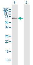 Western blot - Anti-AHNAK2 antibody (AB70053), expandable thumbnail