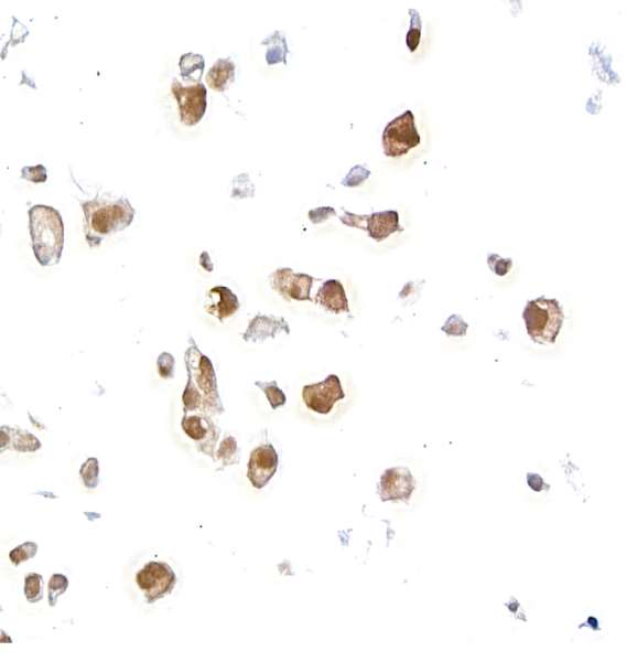 Immunocytochemistry - Anti-AHR antibody [BLR118H] - BSA free (AB314060), expandable thumbnail