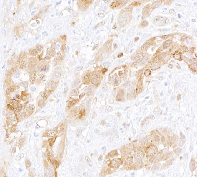 Immunohistochemistry (Formalin/PFA-fixed paraffin-embedded sections) - Anti-AHR antibody [BLR118H] - BSA free (AB314060), expandable thumbnail