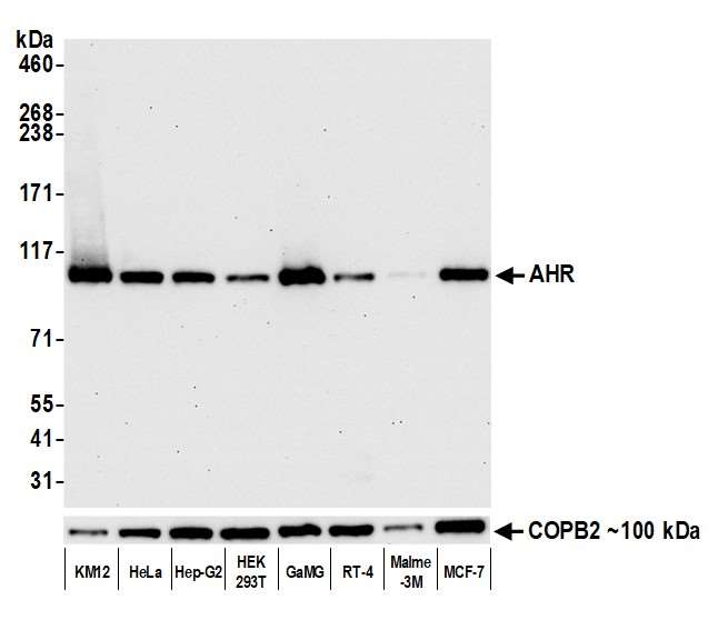 Western blot - Anti-AHR antibody [BLR118H] - BSA free (AB314060), expandable thumbnail