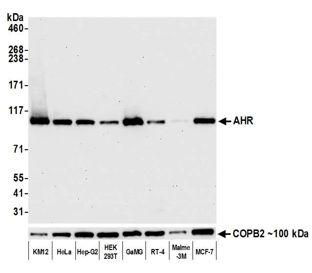 Western blot - Anti-AHR antibody [BLR118H] - BSA free (AB314060)