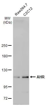 Western blot - Anti-AHR antibody [HL1984] (AB308215)