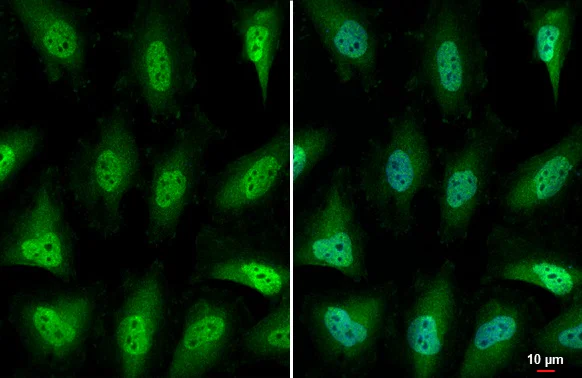 Immunocytochemistry/ Immunofluorescence - Anti-AHR antibody [HL1984] - BSA and Azide free (AB308215)