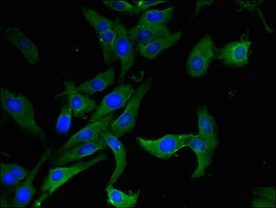 Immunocytochemistry/ Immunofluorescence - Anti-AHRR antibody (AB234817)