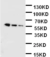 Western blot - Anti-AHSG antibody (AB112528)
