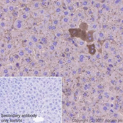Immunohistochemistry (Formalin/PFA-fixed paraffin-embedded sections) - Anti-AHSG antibody [EPR17839-163] (AB187051)