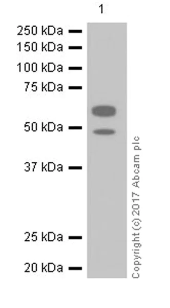 Western blot - Anti-AHSG antibody [EPR17839-163] (AB187051)