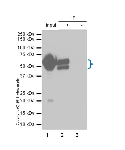 Immunoprecipitation - Anti-AHSG antibody [EPR17839-163] - BSA and Azide free (AB226243)