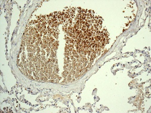 Immunohistochemistry (Formalin/PFA-fixed paraffin-embedded sections) - Anti-Ahsp antibody [EPR12319] (AB180861)