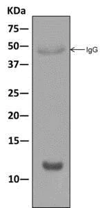 Immunoprecipitation - Anti-Ahsp antibody [EPR12319] (AB180861)