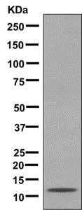 Western blot - Anti-Ahsp antibody [EPR12319] (AB180861)