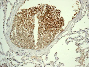 Immunohistochemistry (Formalin/PFA-fixed paraffin-embedded sections) - Anti-Ahsp antibody [EPR12319] - BSA and Azide free (AB250261)