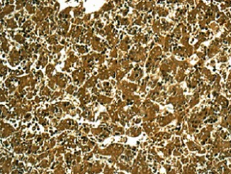Immunohistochemistry (Formalin/PFA-fixed paraffin-embedded sections) - Anti-Ahsp antibody [EPR12319] - BSA and Azide free (AB250261)