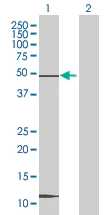 Western blot - AIBZIP overexpression 293T lysate (whole cell) (AB94227)