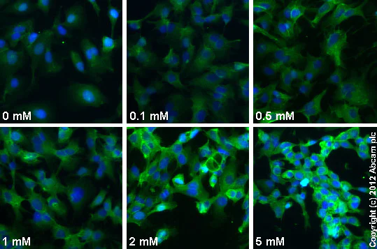 Functional Studies - AICAR (Acadesine/AICA riboside), AMPK activator (AB120358)