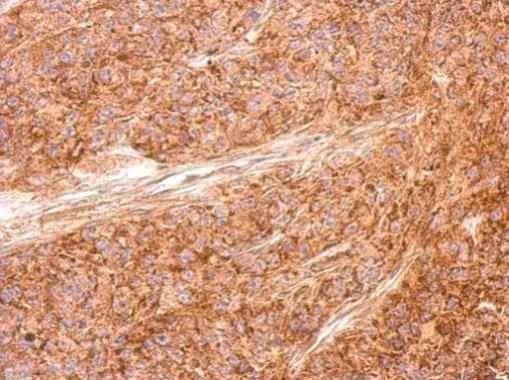 Immunohistochemistry (Formalin/PFA-fixed paraffin-embedded sections) - Anti-AICDA antibody (AB183618)