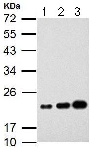 Western blot - Anti-AICDA antibody (AB183618), expandable thumbnail