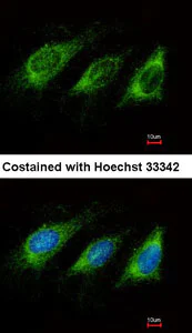 Immunocytochemistry/ Immunofluorescence - Anti-AICDA antibody - Aminoterminal end (AB137397)
