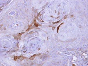 Immunohistochemistry (Formalin/PFA-fixed paraffin-embedded sections) - Anti-AICDA antibody - Aminoterminal end (AB137397)