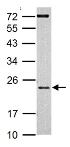 Western blot - Anti-AICDA antibody - Aminoterminal end (AB137397)