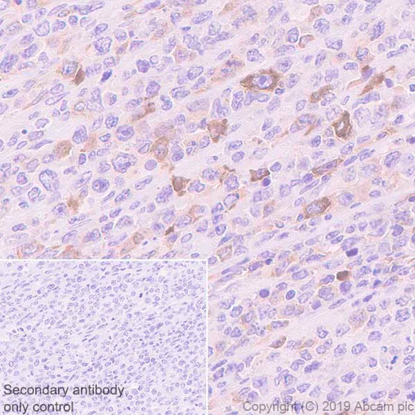 Immunohistochemistry (Formalin/PFA-fixed paraffin-embedded sections) - Anti-AICDA antibody [EPR23436-45] - ChIP Grade (AB269454)