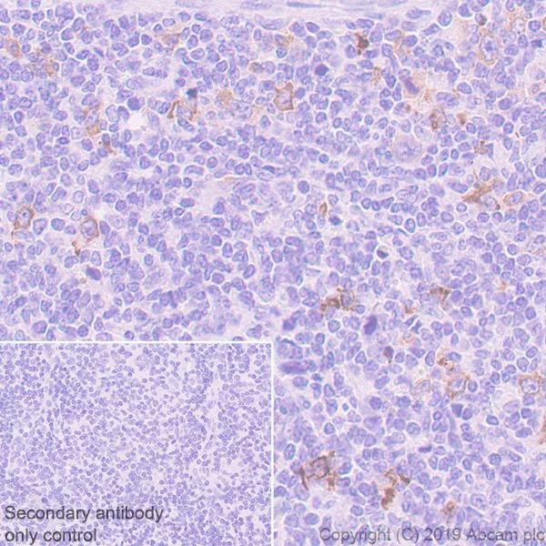 Immunohistochemistry (Formalin/PFA-fixed paraffin-embedded sections) - Anti-AICDA antibody [EPR23436-45] - ChIP Grade (AB269454)