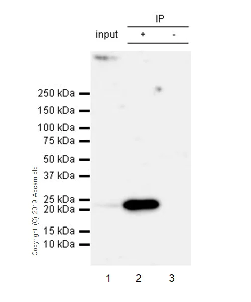 Immunoprecipitation - Anti-AICDA antibody [EPR23436-45] - ChIP Grade (AB269454)