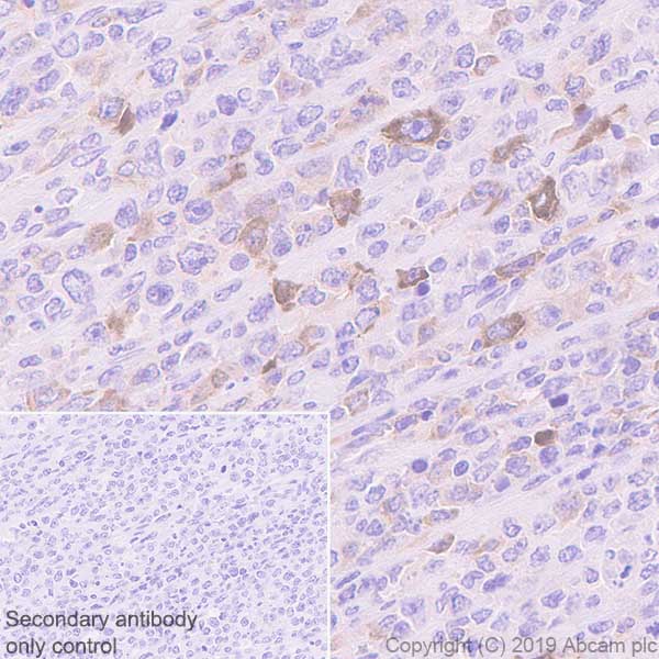 Immunohistochemistry (Formalin/PFA-fixed paraffin-embedded sections) - Anti-AICDA antibody [EPR23436-45] - ChIP Grade - BSA and Azide free (AB269457), expandable thumbnail