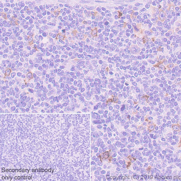Immunohistochemistry (Formalin/PFA-fixed paraffin-embedded sections) - Anti-AICDA antibody [EPR23436-45] - ChIP Grade - BSA and Azide free (AB269457), expandable thumbnail